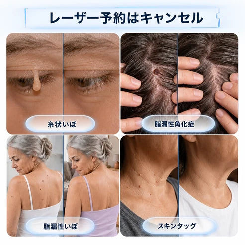 5日で効果を実感 ― Hiskin® 2-in-1 マイクロニードル・ハイドロコロイドパッチ：肌の気になる箇所をケアする、痛みや跡が残らない高品質なパッチです。