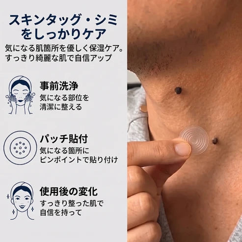5日で効果を実感 ― Hiskin® 2-in-1 マイクロニードル・ハイドロコロイドパッチ：肌の気になる箇所をケアする、痛みや跡が残らない高品質なパッチです。