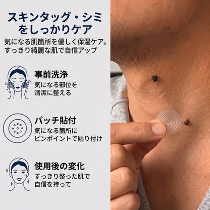 5日で効果を実感 ― Hiskin® 2-in-1 マイクロニードル・ハイドロコロイドパッチ：肌の気になる箇所をケアする、痛みや跡が残らない高品質なパッチです。