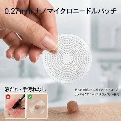 5日で効果を実感 ― Hiskin® 2-in-1 マイクロニードル・ハイドロコロイドパッチ：肌の気になる箇所をケアする、痛みや跡が残らない高品質なパッチです。